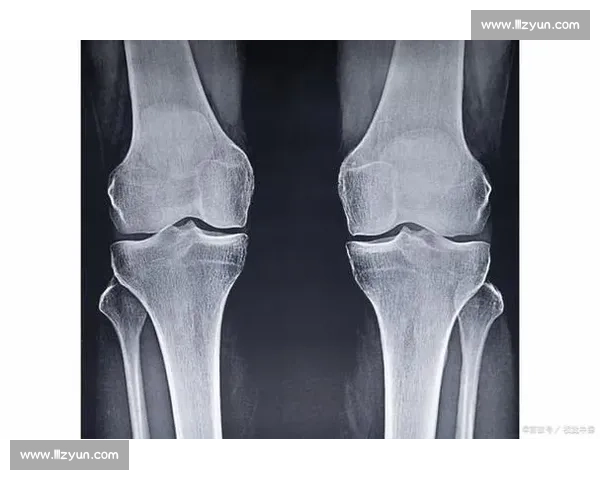 18 岁骨骺线未闭合?科学 3 招助你再长高 5cm